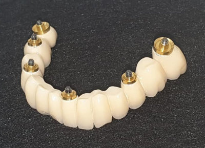 Implant dentaire MEAUX 